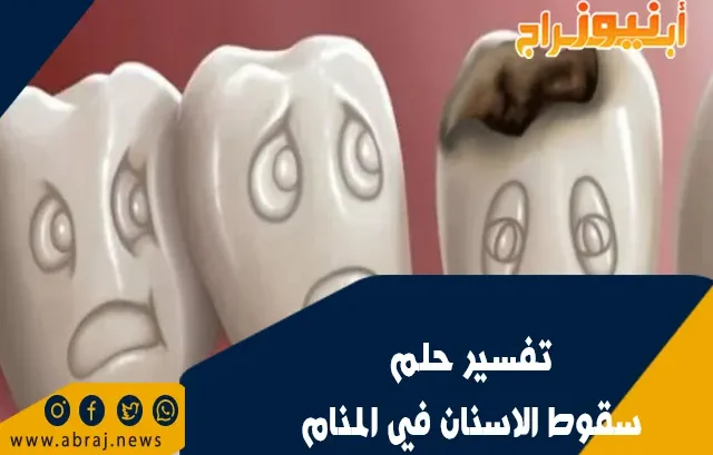 تفسير حلم سقوط الاسنان في المنام
