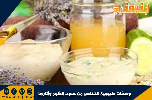 وصفات طبيعية للتخلص من حبوب الظهر وآثارها