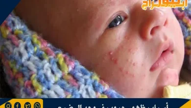 أسباب ظهور حبوب في وجه الرضيع ونصائح لعلاجها 5 أسباب ظهور حبوب في وجه الرضيع